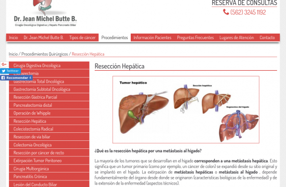 Operación de cáncer de colon