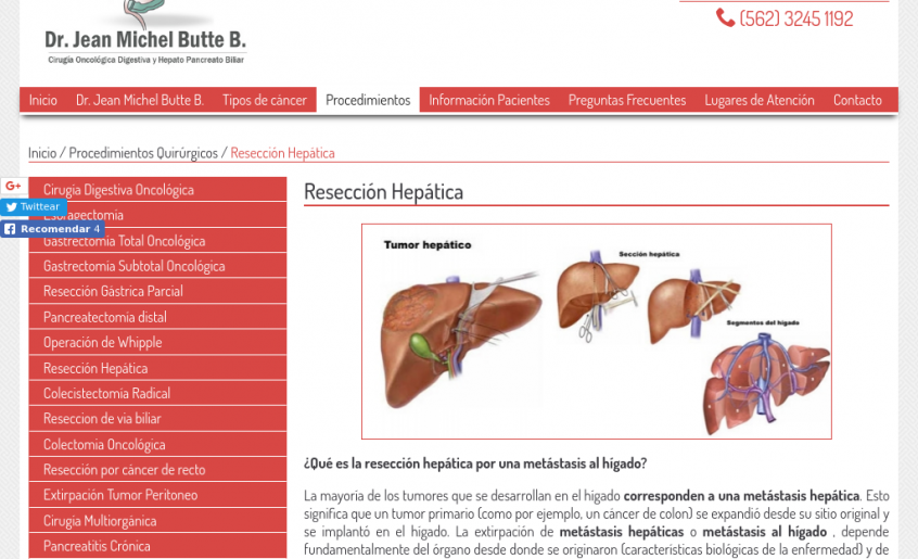 Operación de cáncer de colon